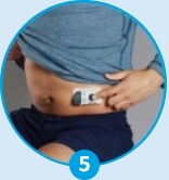 תמונה של אדם ממקפ את אביזר ההזרקה
